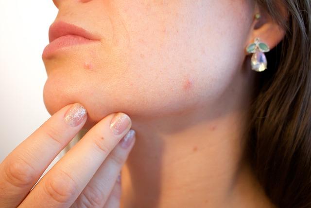 Jak pečovat o pokožku po depilaci voskem pro optimální účinek