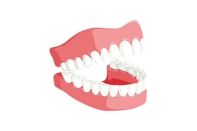 Co je bělení zubů laserem?